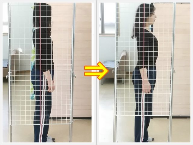 成人式、キレイな姿勢で迎えよう！