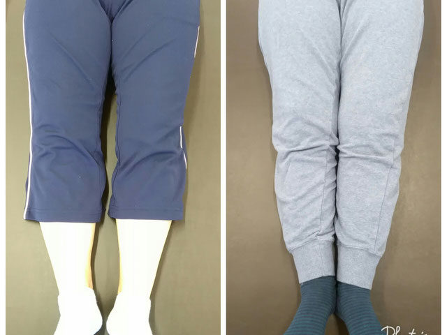 そのO脚放置したままはNGです！