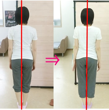 良い姿勢って何！？【姿勢の基準】